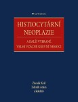 Histiocytární neoplazie další vybrané vzácné krevní nemoci