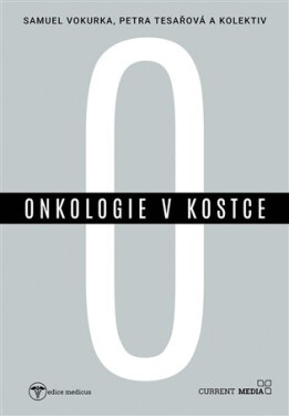 Onkologie kostce Petra Tesařová
