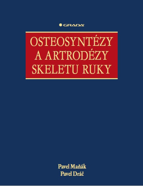 Osteosyntézy a artrodézy skeletu ruky - Pavel Maňák, Pavel Dráč
