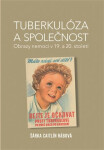 Tuberkulóza společnost