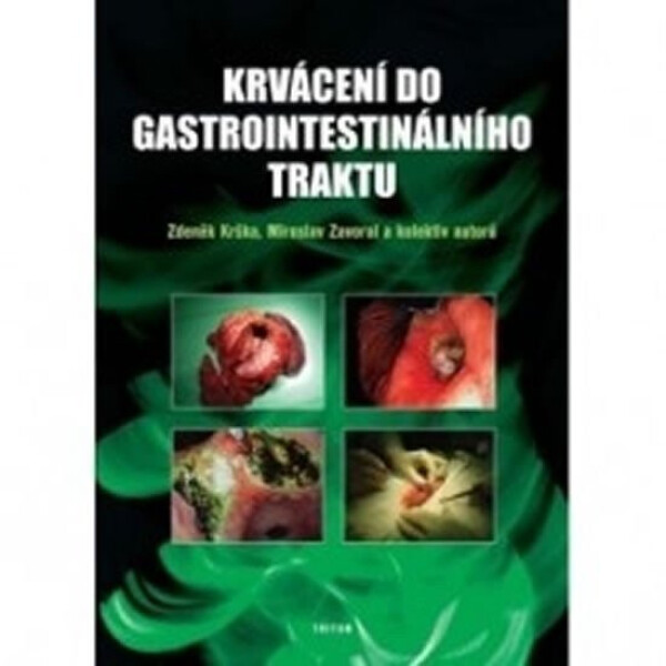 Krvácení do gastrointestinálního traktu - Zdeněk Krška