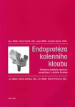 Endoprotéza kolenního kloubu - Pavel Vavřík