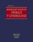 Minimálně invazivní operace v gynekologii - David Kužel, Zdeněk Holub - e-kniha