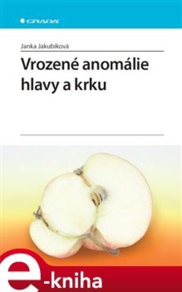 Vrozené anomálie hlavy a krku - Janka Jakubíková e-kniha