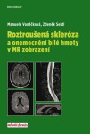 Roztroušená skleróza a onemocnění bílé hmoty v MR zobrazení | Manuela Vaněčková, Zdeněk Seidl