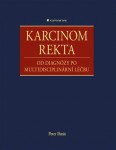 Karcinom rekta Peter Ihnát