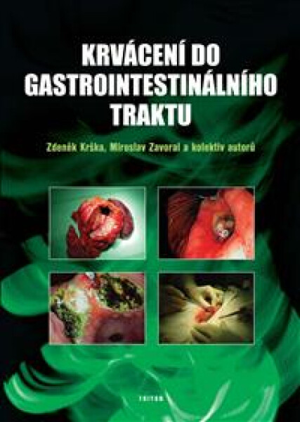 Krvácení do gastrointestinálního traktu - Zdeněk Krška