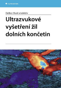 Ultrazvukové vyšetření žil dolních končetin Dalibor Musil e-kniha