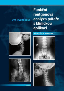 Funkční rentgenová analýza páteře s klinickou aplikací - Eva Rychlíková