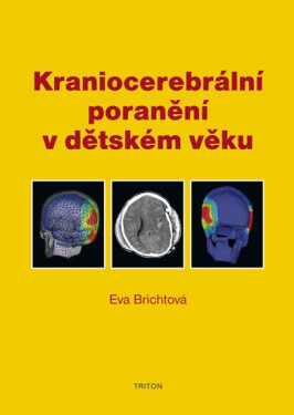 Kraniocerebrální poranění v dětském věku - Eva Brichtová