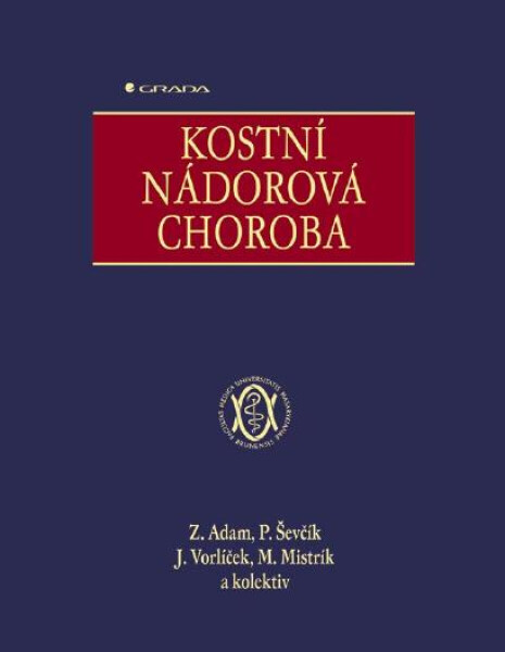 Kostní nádorová choroba - Pavel Ševčík, Zdeněk Adam, Jiří Vorlíček, Martin Mistrík