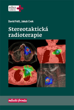 Stereotaktická radioterapie David Feltl,