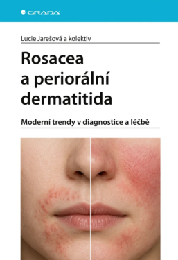 Rosacea a periorální dermatitida - kolektiv autorů, Lucie Jarešová