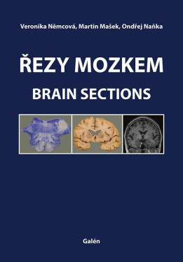 Řezy mozkem / Brain Sections - Ondřej Naňka