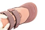 Protetika Plus Protetika Sety Nude