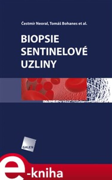 Biopsie sentinelové uzliny - Čestmír Neoral, Tomáš Bohanec e-kniha
