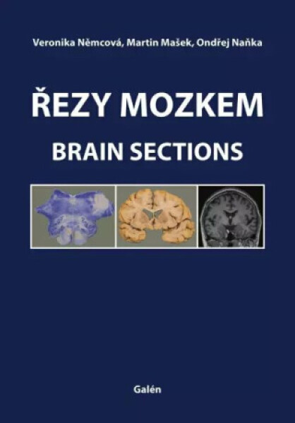Řezy mozkem / Brain Sections - Ondřej Naňka, Martin Mašek, Veronika Němcová