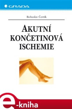 Akutní končetinová ischemie - Bohuslav Čertík e-kniha