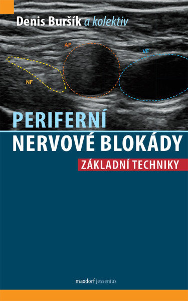 Periferní nervové blokády - Základní techniky - Denis Buršík