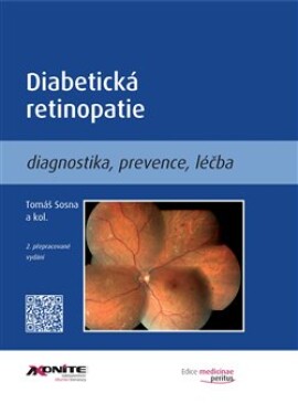Diabetická retinopatie Tomáš Sosna,