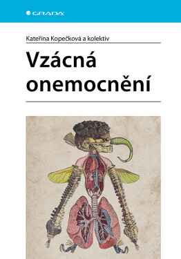 Vzácná onemocnění - Kateřina Kopečková