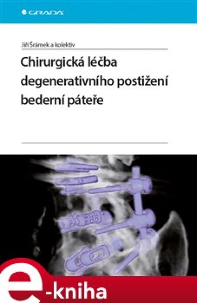 Chirurgická léčba degenerativního postižení bederní páteře - Jiří Šrámek, kolektiv autorů e-kniha