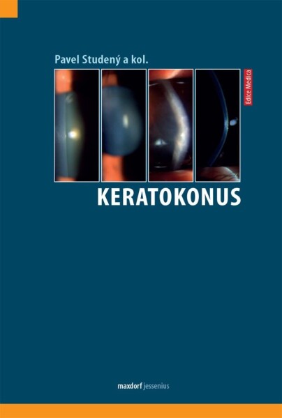 Keratokonus Pavel Studený