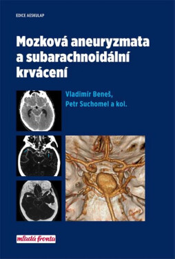 Mozková aneurysmata subarachnoidální krvácení Vladimír Beneš