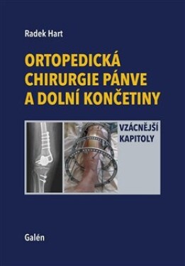 Ortopedická chirurgie pánve dolní končetiny