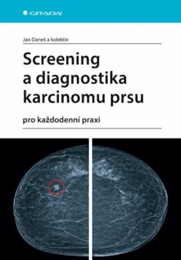 Screening a diagnostika karcinomu prsu - kolektiv autorů, Jan Daneš - e-kniha