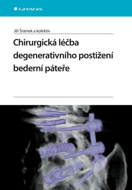 Chirurgická léčba degenerativního postižení bederní páteře - Jiří Šrámek